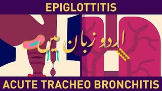 Pediatric respiratory illnesses Croup and Epiglottitis in Urdu [upl. by Nollaf]