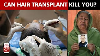 Can You Die Of Hair Transplant Surgery Doctors Explain [upl. by Lairret711]