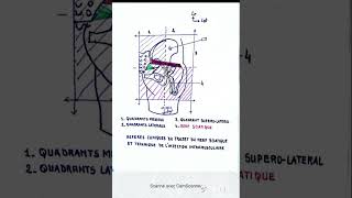 Les repères cliniques du trajet du nerf sciatique et technique de l injection intramusculaire [upl. by Emilie860]