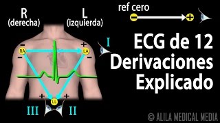 ECG de 12 Derivaciones Explicado Animación Alila Medical Media Español [upl. by Ahsal]