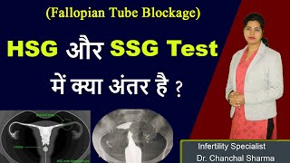 Difference Between HSG and SSG Test for Fallopian Tube Blockage  Aasha Ayurveda [upl. by Tarabar]