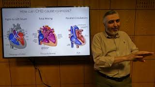 Pathophysiology of Cyanotic Congenital Heart Disease  Hatem Hosny [upl. by Cheatham]