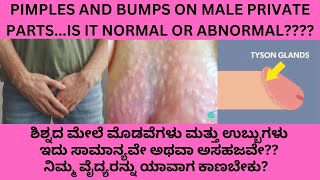 Pimples White Spots Bumps  Yellow Spots Rashes on the male private parts it normal [upl. by Ahcas]