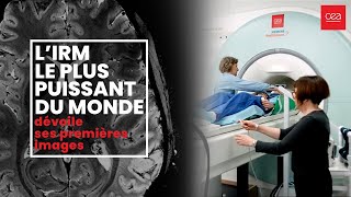 🧠Première mondiale Le cerveau dévoilé comme jamais grâce à l’IRM le plus puissant au monde [upl. by Zipporah283]