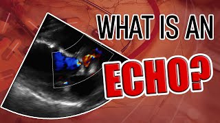 Echo BachelorClass  Your introduction to basic echocardiography [upl. by Rayburn976]