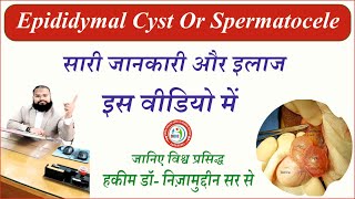 Everything you need to know about Spermatocele or Epididymal Cyst And Unani Nuskha by Dr Nizamuddin [upl. by Tlevesor358]