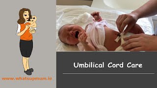 Umbilical Cord Care [upl. by Boothman]