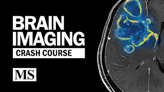 Brain Imaging Crash Course [upl. by Celio604]