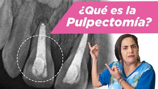 Pulpectomía ¿Qué es ¿Cuándo se debe hacer [upl. by Silvia]