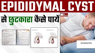 Epididymal सिस्ट cyst से छुटकारा कैसे पायें  Get rid of Epididymal cyst naturally  DrHealth [upl. by Latashia936]