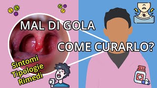 Come Riconoscere un Mal di Gola Virale da uno Batterico Sintomi e Trattamenti [upl. by Yffub]