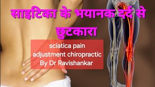 sciatica pain adjustment chiropractic  साइटिका के दर्द  viral trending shorts [upl. by Kinghorn]