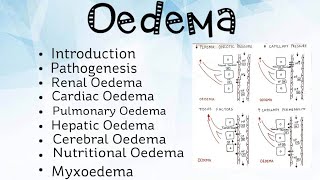 Oedema Pathology [upl. by Dorrie]