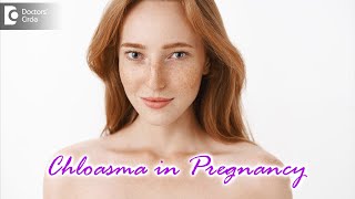 CHLOASMA IN PREGNANCY What is it Causes Symptoms amp Treatment  DrAruna Prasad  Doctors Circle [upl. by Leunamnauj]