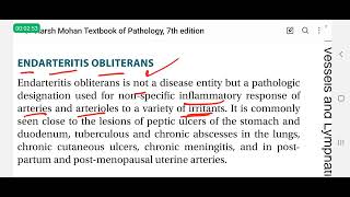 Endarteritis obliterans in Hindi  pathology lectures [upl. by Sascha239]