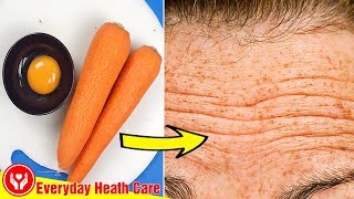 How To Remove Wrinkles Naturally  Remove Forehead Wrinkles With 2 Natural Ingredients [upl. by Enoek]