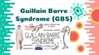 GuillainBarre Syndrome  Its Causes  Pathophysiology Risk Factors Sign amp Symptoms [upl. by Mckay344]