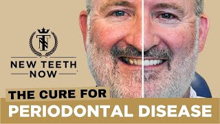 Cure for Periodontal Disease [upl. by Grissom]