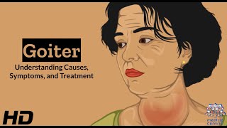 Thyroid Troubles Navigating Goiter  Causes Symptoms and Treatment Explained [upl. by Manbahs]