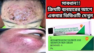 Betnovate n skin cream  বেটনোভেট এন ক্রিম এর কাজ কি ত্বক ফর্সাকারী ক্রিম  Betnovate N Cream [upl. by Jerrome710]