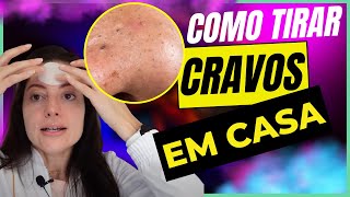 Especialista explica COMO REMOVER CRAVOS do nariz em 10 MINUTOS [upl. by Frankel]