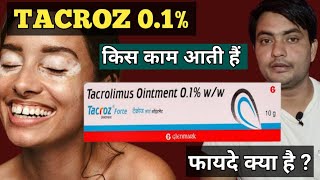 tacroz forte 01 ointment  tacroz ointment 01  use in hindi [upl. by Lanny430]