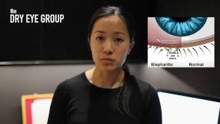 Blepharitis Treatment Blephex amp Dry Eye Treatment — The Dry Eye Group [upl. by Gnek]