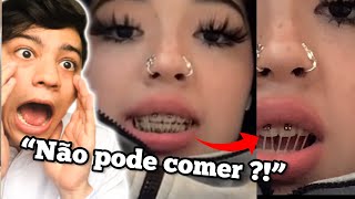 O dentista teve que AMARRAR a BOCA TODA dela com elásticos  Explicação [upl. by Tilda]