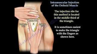 Deltoid Intramuscular injection  Everything You Need To Know  Dr Nabil Ebraheim [upl. by Nanahs]