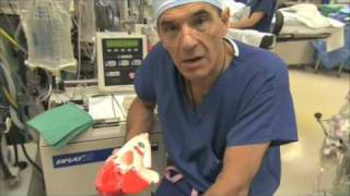 Heart Valve Replacement Surgery Explained Part 1 [upl. by Cyrano]