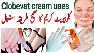 clobevate cream for hands and feet whitening  clobevate for skin whiteing  clobetasol  eczema [upl. by Neerbas]