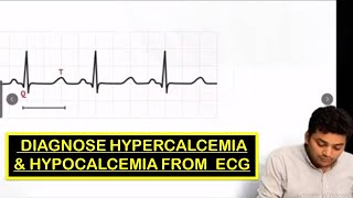 How to diagnose Hypercalcemia amp Hypocalcemia from ECG FMGENEXTUSMLENEETPGMRCPINICETAMC [upl. by Damiano773]