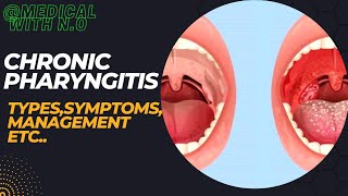 chronic pharyngitis types PATHOPHYSIOLOGY TREATMENT  DIAGNOSIS etc pharyngitis medical [upl. by Jere905]