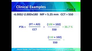 Concepts in Refractive Surgery  part 2 [upl. by Alym]