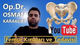 ⭐️Uyluk Kemiği Kırığı Tedavisi Nasıl Yapılıyor 🔴Kalça Kemiği Kırıkları 🔴Femur Kırıkları Nedir [upl. by Nnyroc]