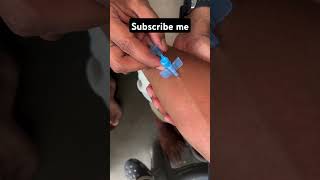 IV Cannula Insertion how To Insert IV Cannula doctor mbbs youtubeshorts ytshorts neet viral [upl. by Enatan]