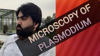 Lec8  Microscopic identification of Plasmodium  Differential diag of four species  UrduHindi [upl. by Kemeny]