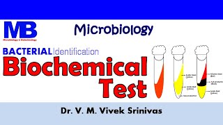 BIOCHEMICAL TEST  Bacterial Identification Technique  Microbiology  Vivek Srinivas Bacteriology [upl. by Buckels]