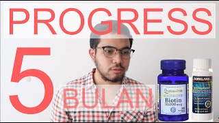 MANJUR  PROGRESS 5 BULAN MINOXIDIL  WAJIB TONTON [upl. by Peria706]