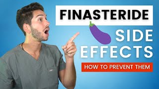 Serious Propecia Side Effects  Finasteride Everything You Need to Know [upl. by Morlee]