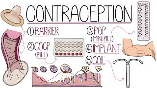 Methods of Contraception Made Easy Contraceptive Methods Explained [upl. by Eednac]