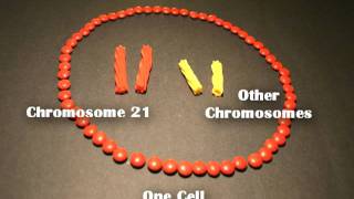 Nondisjunction Trisomy 21  An Animated Tutorial [upl. by Eatnoed]