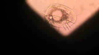 Rotifers and other micro species from a fish tank filter under microscopem2t [upl. by Retep359]