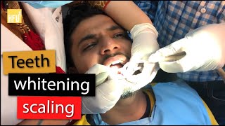 Dental Scaling amp Teeth Whitening Procedure cost time painless  With Dr Vriti Bajaj [upl. by Acirrej92]