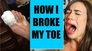 HOW I BROKE MY TOE [upl. by Reiner]