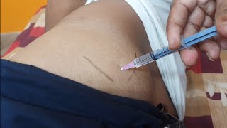 IM इंजेक्शन देने का सही तरीका  Easy steps to give Intramuscular injection  IM injection technique [upl. by Adnohser]