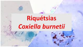 Microbiologia Médica Riquétsias e Coxiella burnetti [upl. by Ttezzil186]