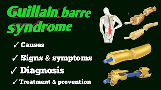 guillain barre syndrome [upl. by Chicoine653]