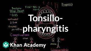 Tonsillopharyngitis  Complications diagnosis and treatment  NCLEXRN  Khan Academy [upl. by Raffo]