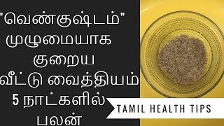 வெண்குஷ்டம் மறைய I vitiligo treatment at home I Tamil health tips [upl. by Ardnoed809]